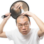 薄毛の原因と対策