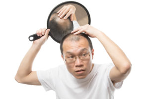 薄毛の原因と対策